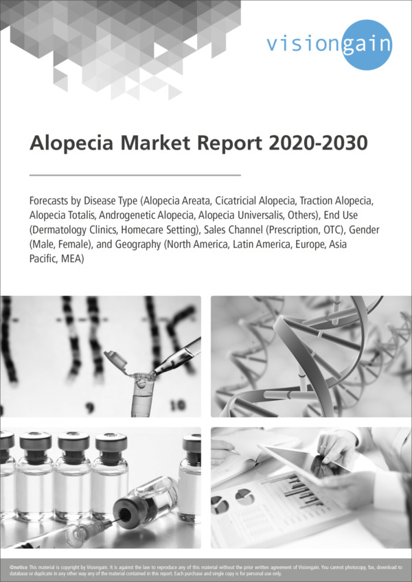Alopecia Market Report 2020-2030
