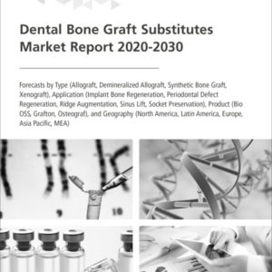 Dental Bone Graft Substitutes Market Report 2020-2030
