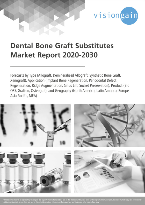 Dental Bone Graft Substitutes Market Report 2020-2030