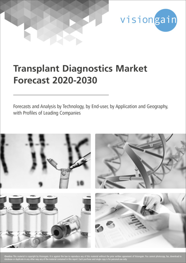Transplant Diagnostics Market Forecast 2020-2030